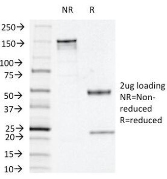 Thymidine Phosphorylase Antibody [P-GF.44C]