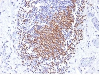 PAX8 Antibody