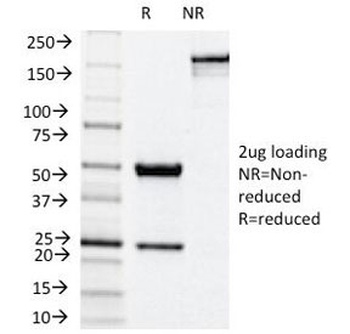 NKX2-2 Antibody