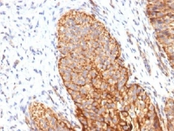 Thrombomodulin Antibody [THBD/1591]