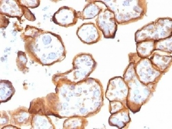 Thrombomodulin Antibody [THBD/1591]
