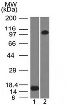 Thrombomodulin Antibody [THBD/1591]