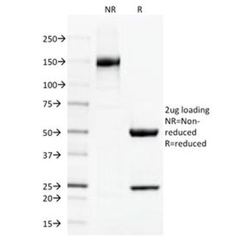 Thrombomodulin Antibody [THBD/1591]