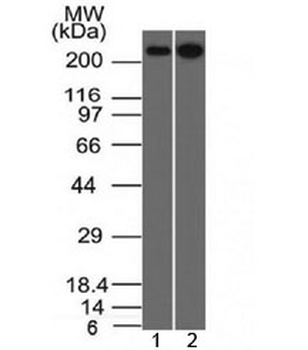 SPTBN2 Antibody [SPTBN2/1582]