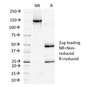 Podoplanin Antibody [PDPN/1433]