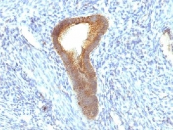 ALPL Antibody