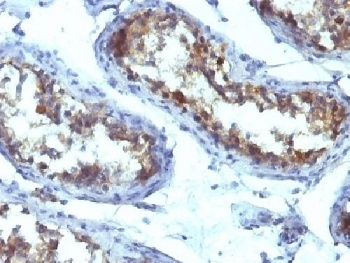 ALPL Antibody