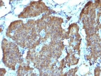 Neuron Specific Enolase Antibody [SPM347]