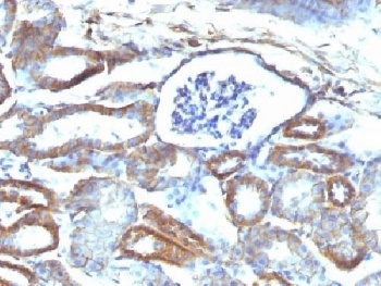 SPTBN2 Antibody