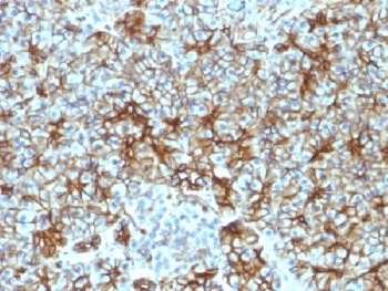 SPTBN2 Antibody