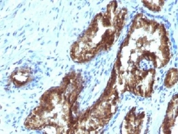 TDP2 Antibody [TDP2/1258]