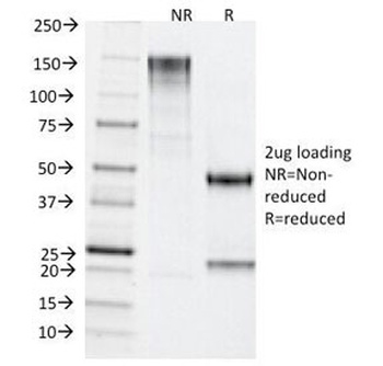 TDP2 Antibody [TDP2/1258]