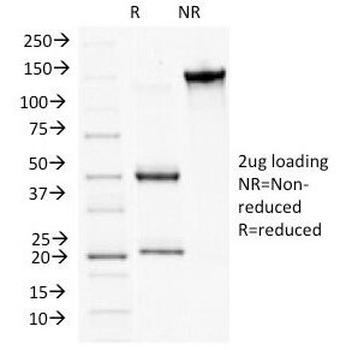 Plakophilin 1 Antibody [10B2]