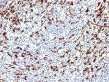 PDCD1 Antibody