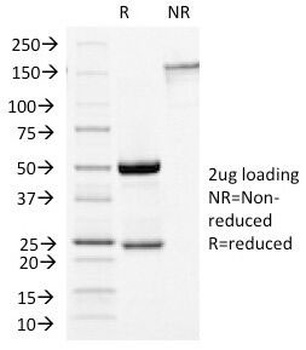 Growth Hormone Antibody [GH/1450]