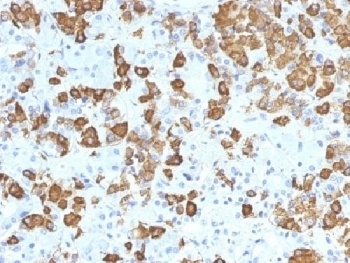 Growth Hormone Antibody [GH/1371]