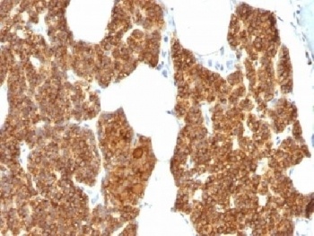 PTH Antibody