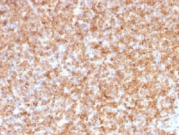 HLA-DPB1, HLA-DQA1 Antibody