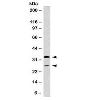 HLA-DPB1, HLA-DQA1 Antibody