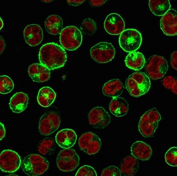 HLA-DPB1, HLA-DQA1 Antibody