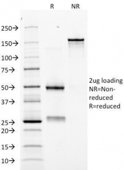 Erythropoietin Antibody [EPO/1368]