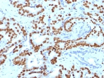 FOXA1 Antibody [FOXA1/1519]
