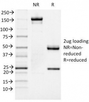 FOXA1 Antibody [FOXA1/1519]