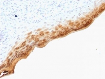 FLI1 Antibody