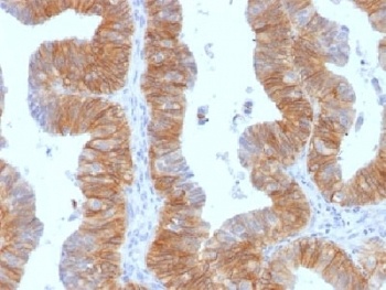EPCAM Antibody