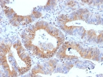 hCG Receptor / LH Receptor Antibody [LHCGR/1417]