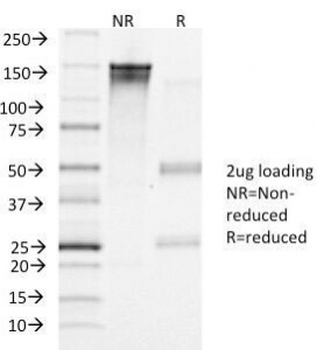 hCG Receptor / LH Receptor Antibody [LHCGR/1417]