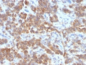 TNFSF15 Antibody