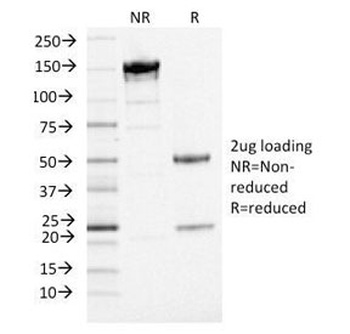DOG1 Antibody [DG1/1484]