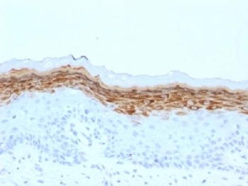 Filaggrin Antibody [FLG/1561]