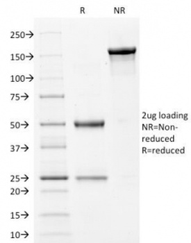 Filaggrin Antibody [FLG/1561]
