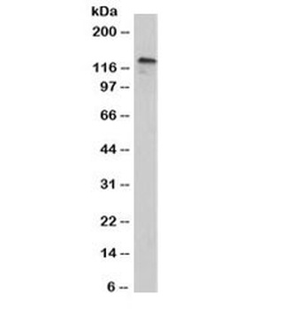 CDH3 Antibody