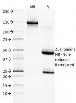 EGF Receptor / EGFR Antibody [GFR/1708]