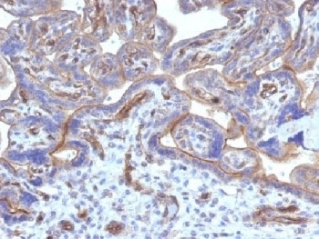 Thrombomodulin Antibody [THBD/1782]