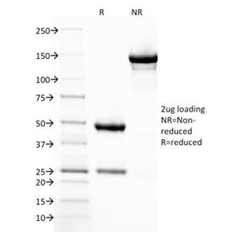 Thrombomodulin Antibody [THBD/1782]