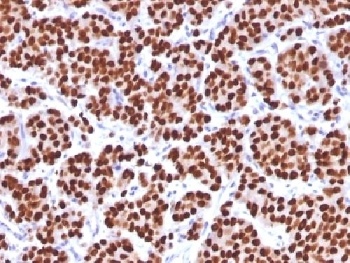 FOXA1 Antibody [FOXA1/1512]