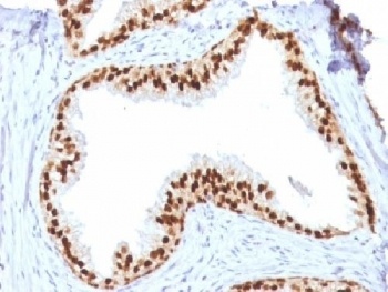 FOXA1 Antibody [FOXA1/1512]