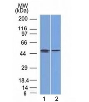 FOXA1 Antibody [FOXA1/1512]