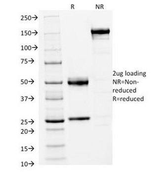 FOXA1 Antibody [FOXA1/1512]