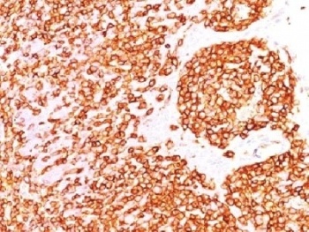 PTPRC Antibody