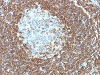 CD3e Antibody [C3e/1308]