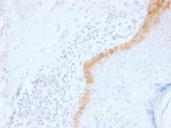 KRT15 Antibody