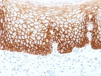 CD44 Antibody
