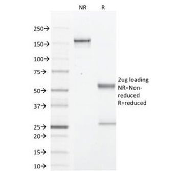 GCDFP-15 Antibody [PIP/1571]