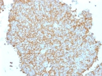 CD99 Antibody