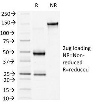 CTNNB1 Antibody